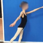 Caz cutremurător: o adolescentă de 17 ani cântărește 27 de kilograme. Părinții au înfometat-o pentru că își doreau un copil mic