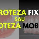 Proteză dentară mobilă sau proteză dentară fixă? Cât de mare este diferența? (P)