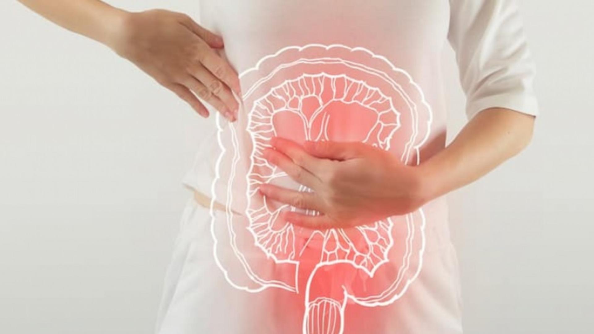 Epidemia de cancer colorectal la persoanele sub 50 de ani: simptomele pe care medicii le-au ratat. Alimentul comun care ar putea cauza criza