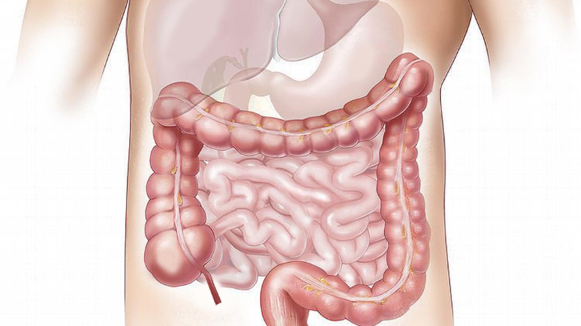 Alimente care previn cancerul de colon. Trebuie să le introduci în alimentația ta