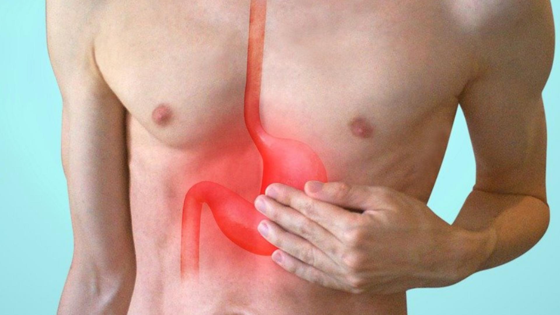 Metode naturale de ameliorare a refluxului gastric. Cum poți evita aceste simptome