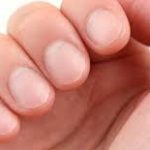 Ce afecțiuni indică unghiile fragile. Semnale pe care le transmite organismul și la care trebuie să fii atent
