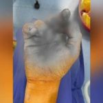 Incident în Brăila: doi copii răniți în urma exploziei unei petarde