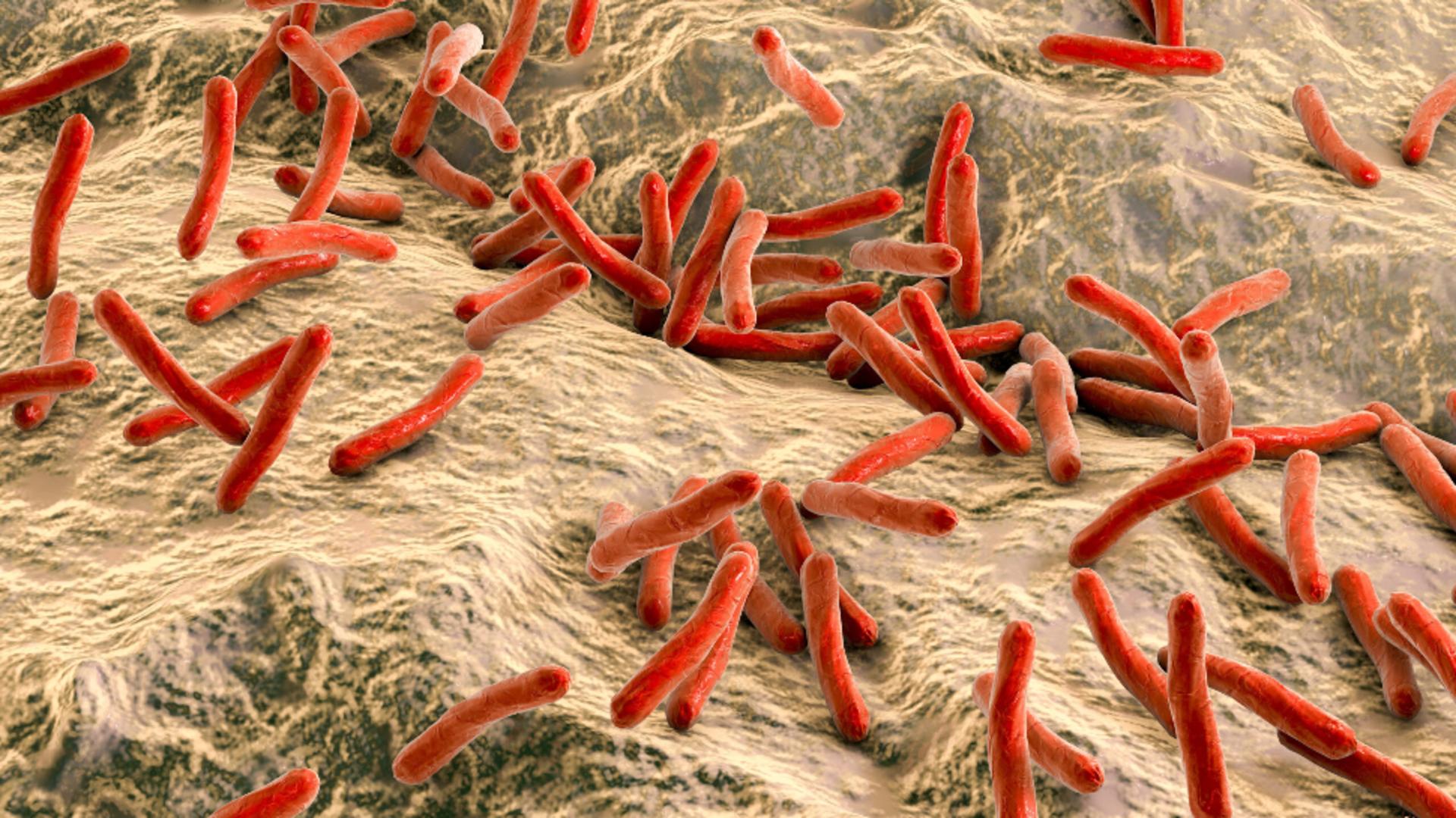 Autoritățile din Cluj spun că au sub control situația cazurilor de lepră: „Nu există un risc major pentru populație”