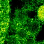 Cât de contagioasă este lepra? Ce spun specialiștii