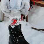 Remedii naturale pentru degerături. Cum să le folosești corect!