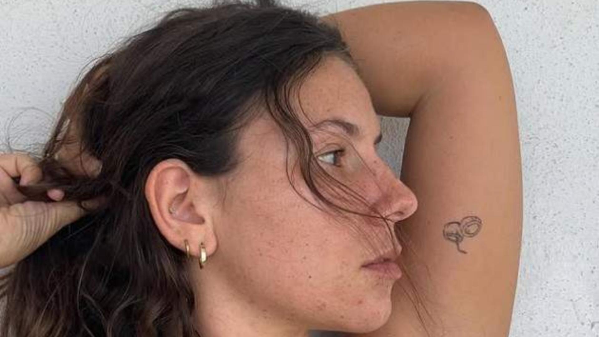 Tânăra care și-a pierdut vederea la ochiul drept din cauza unui parazit: „Sunt în întuneric de două săptămâni”