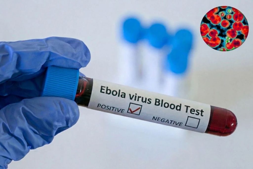 Epidemia de Ebola se extinde. Cinci țări, afectate de focarul mortal: Nigeria este ultimul stat afectat